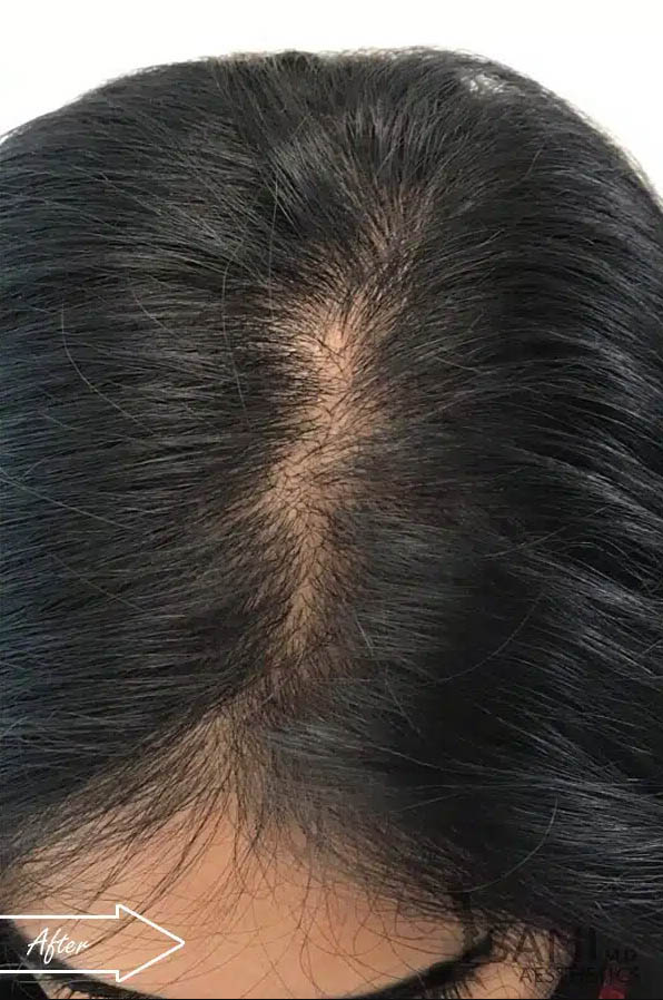 gilbertmedspa - Before Treatment