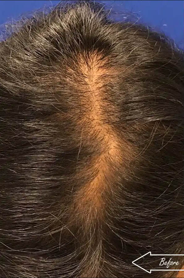 gilbertmedspa - Before Treatment