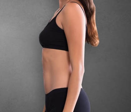 gilbertmedspa - Before Treatment