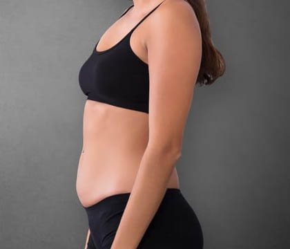 gilbertmedspa - Before Treatment