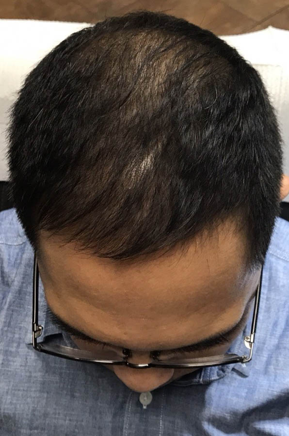 gilbertmedspa - Before Treatment